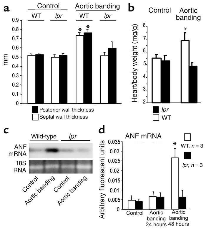 Cardiac hypertrophy in wild-type but not lpr mice after pressure overloa...