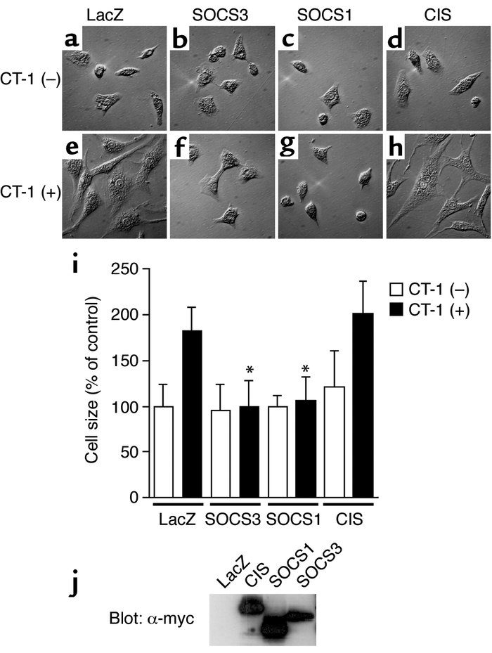 Suppression of CT-1–induced cardiomyocyte hypertrophy by SOCS3 and SOCS1...