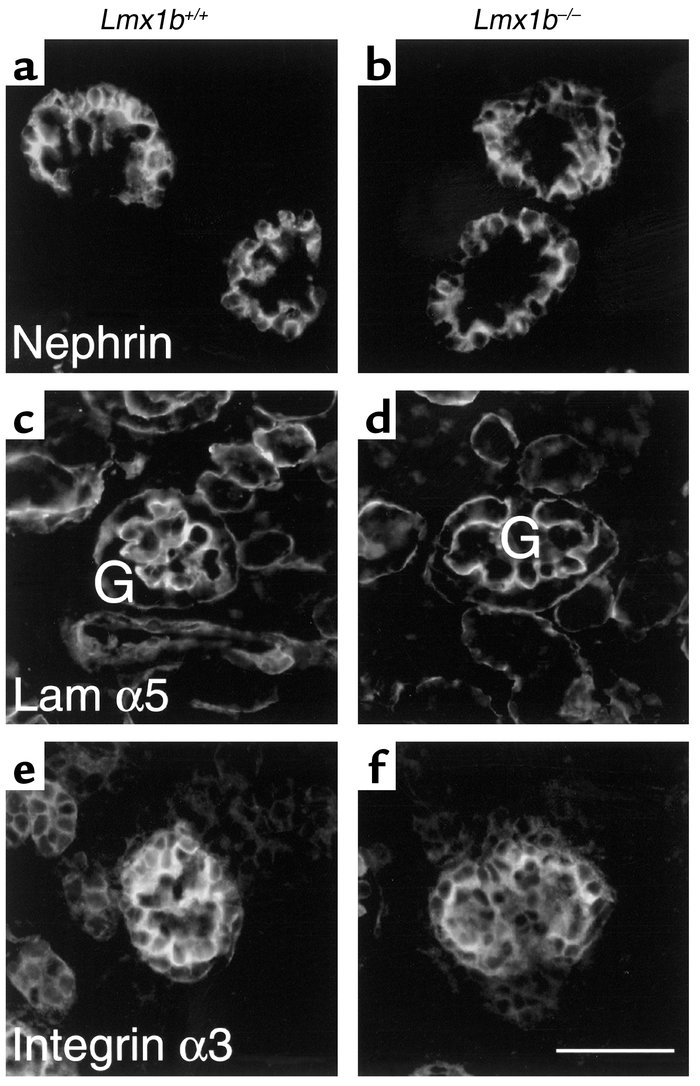 Immunohistochemical analysis of podocyte gene expression in Lmx1b+/+ and...