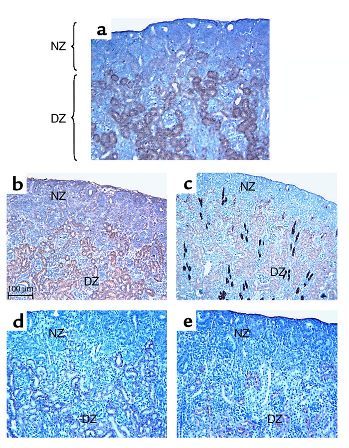 Expression of p53 correlates with terminal epithelial differentiation. C...