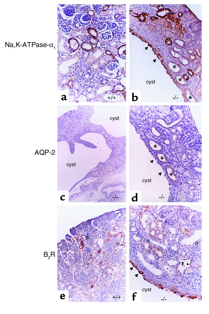 Abnormal spatial expression of RFG products in p53-null mice. Immunoloca...