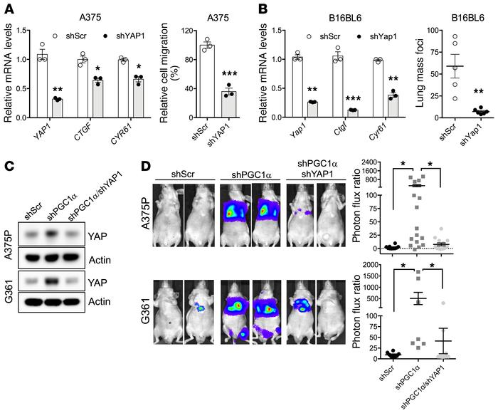 YAP is required for melanoma migration and metastasis instigated by loss...