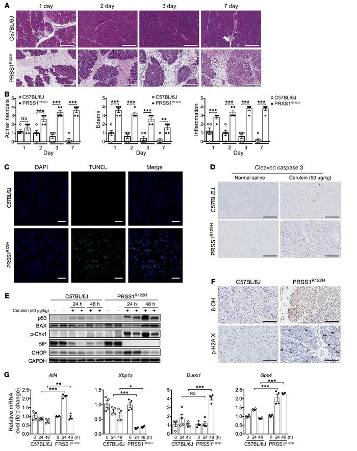 Progressive pancreatic damage and activation of stress signaling pathway...