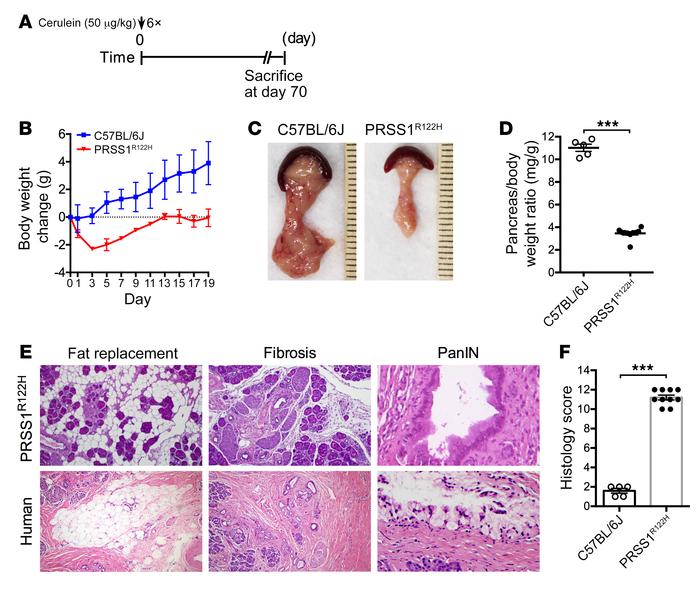 CP developed in transgenic PRSS1R122H mice.
(A) Schema of cerulein admin...