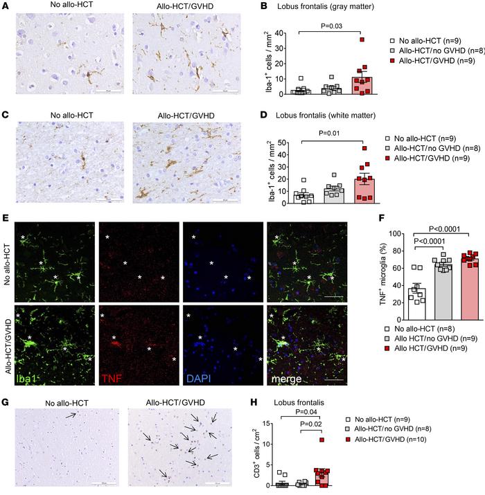 Microglia are activated and T cells infiltrate the CNS of GVHD patients....