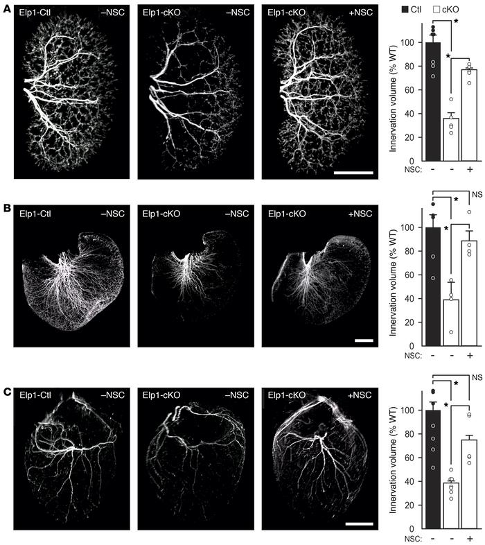 The phosphatase inhibitor NSC87877 (NSC) rescues sympathetic target tiss...