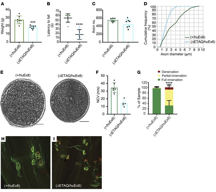 In vivo characterization of the ΔETAQ GARS variant.
(A) GarsΔETAQ/huEx8 ...