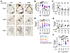 TCR sequences from human TB granulomas.