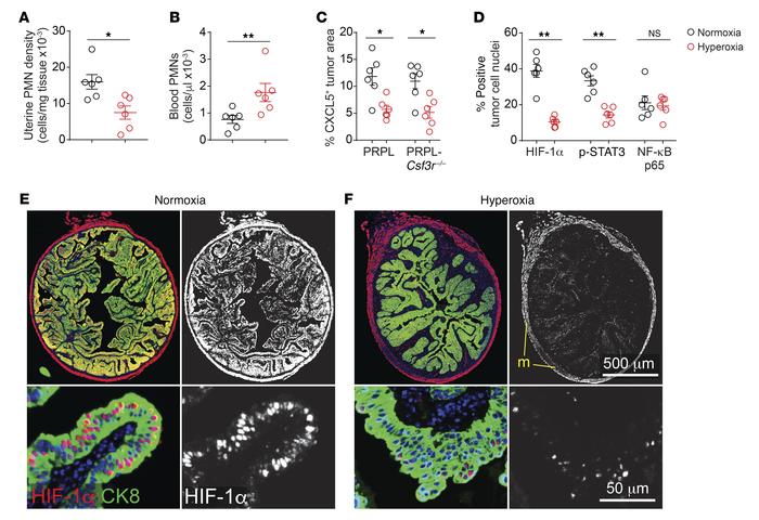 Improved tumor oxygenation reduces PMN recruitment to PRPL tumors.
Mice ...