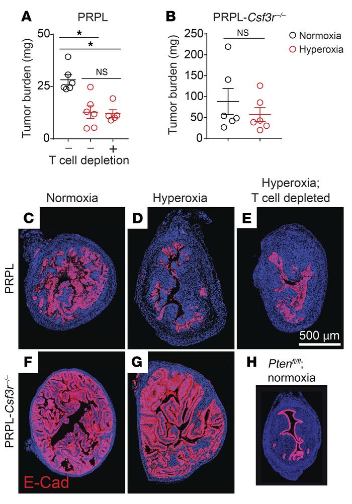 Relief of tumor hypoxia improves net PMN-dependent tumor control.
(A and...