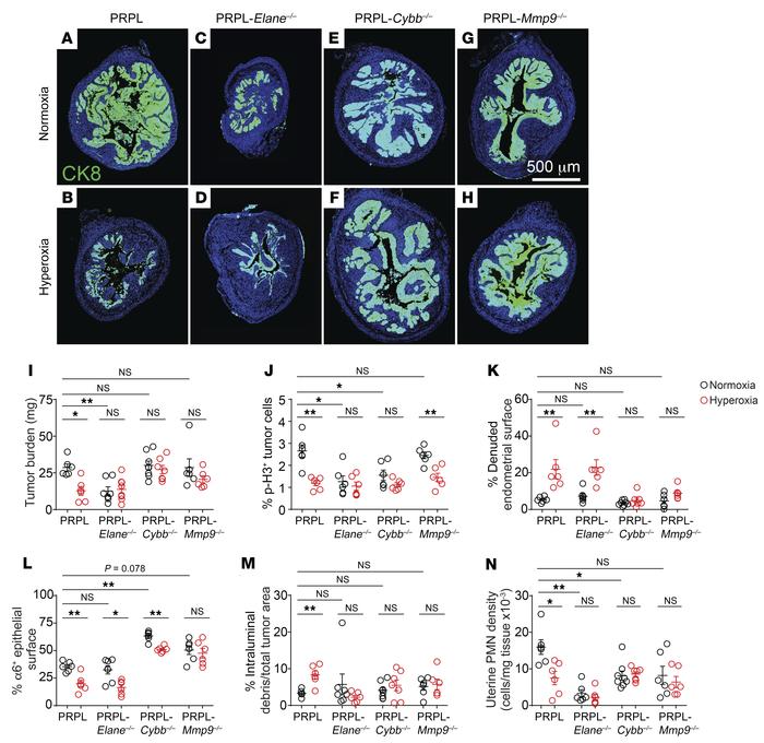 Role of NE, neutrophil-derived ROS, and MMP-9 in PMN control over tumor ...