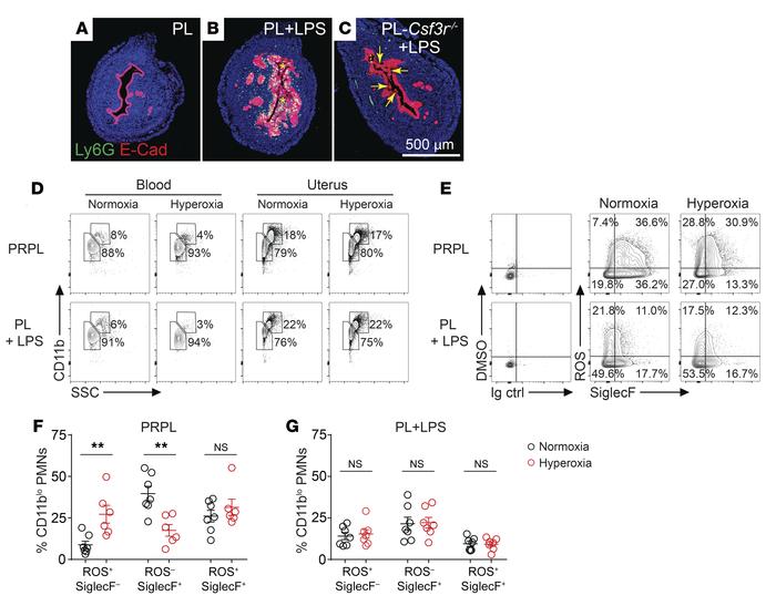 Relief of tumor hypoxia alters the phenotype of tumor-associated PMNs.
P...