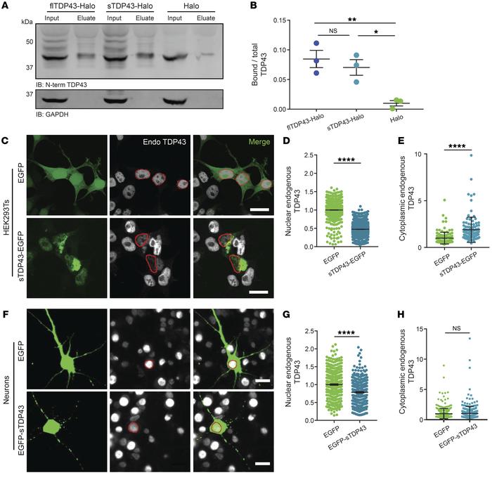 sTDP43 overexpression leads to the cytoplasmic deposition and nuclear cl...