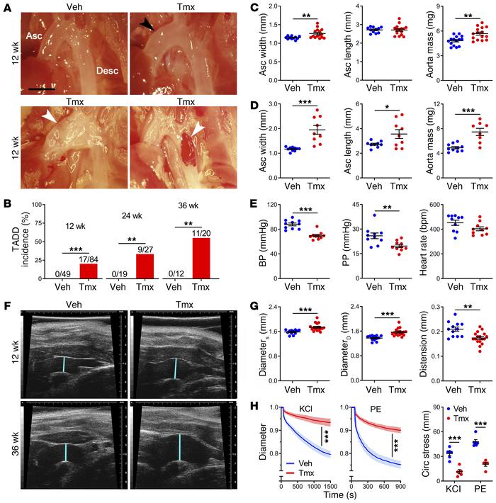 
Tsc1 deletion in SMCs results in progressive aortic disease and dysfunc...