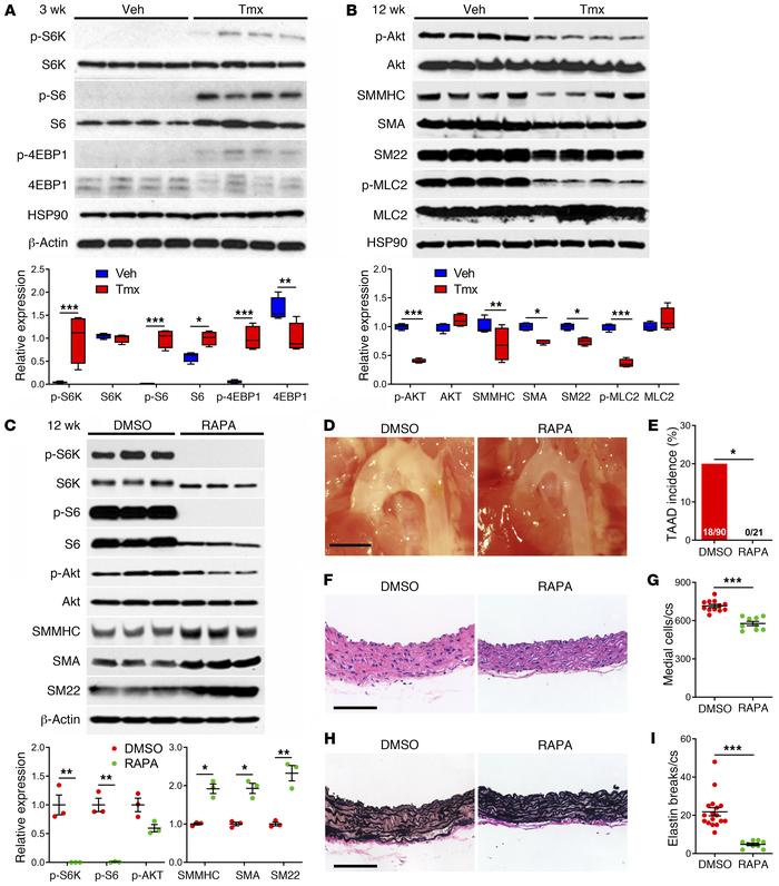 mTOR activation and inhibition in Tsc1-deficient aortas.
Tsc1fl/fl Myh11...