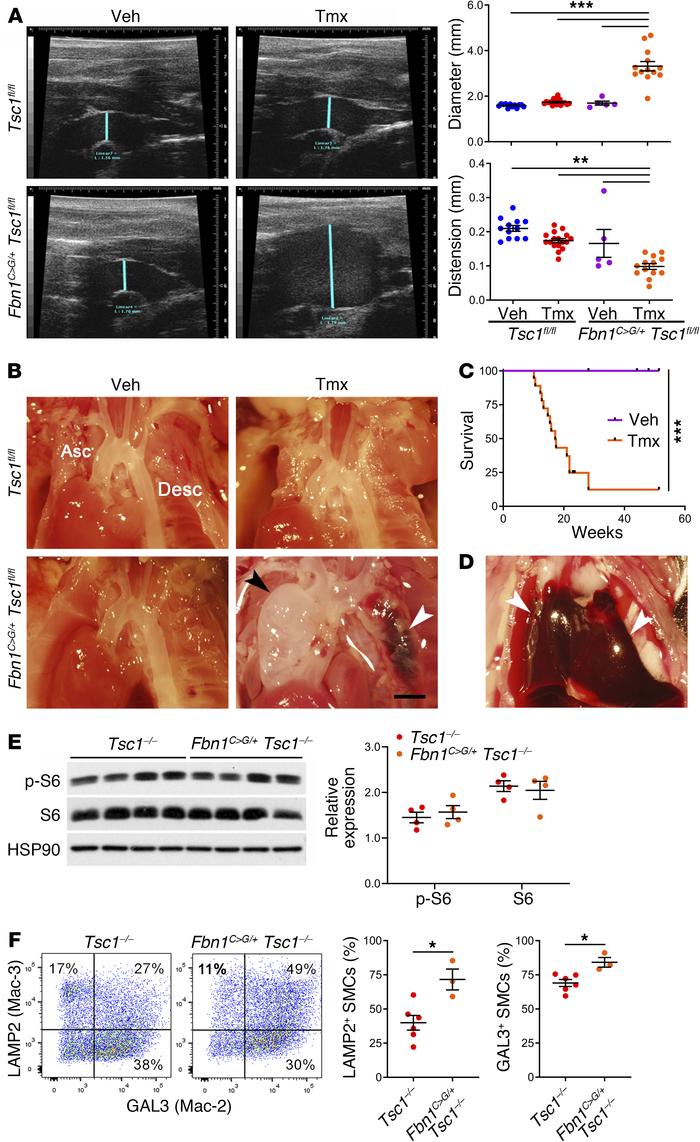 Degradative SMCs exacerbate TAAD in a murine model of Marfan syndrome.
T...