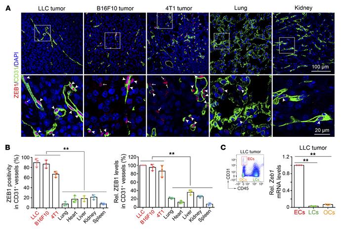 Endothelial ZEB1 expression is enhanced in various mouse tumor models.
(...