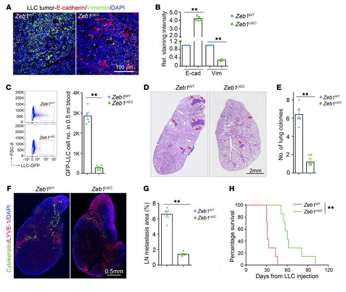 Endothelial ZEB1 deletion impedes LLC tumor intravasation and metastasis...