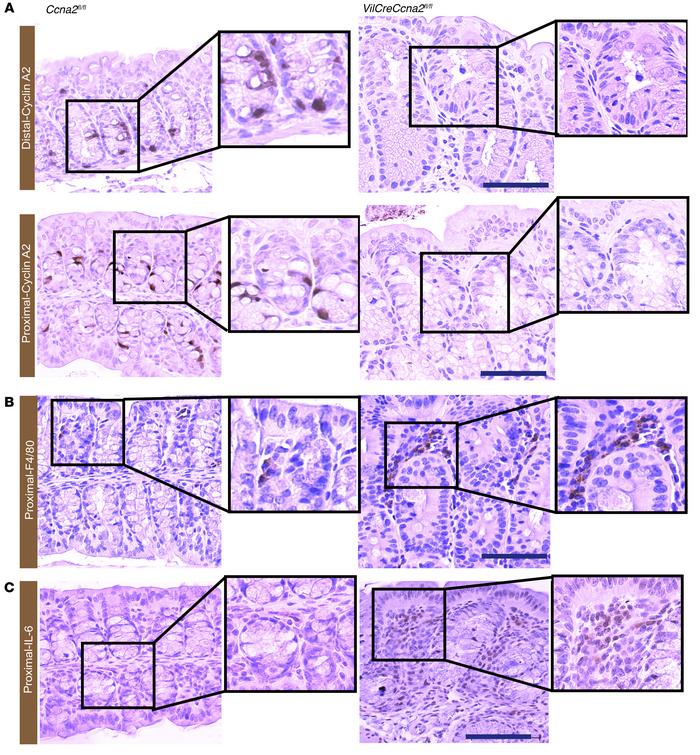Cyclin A2 deletion leads to epithelial changes in the colon mucosa and i...