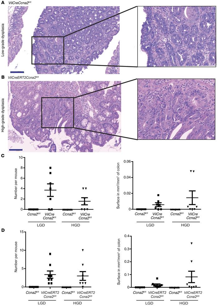 Dysplasia formation in cyclin A2–deficient mice.
(A and B) Representativ...