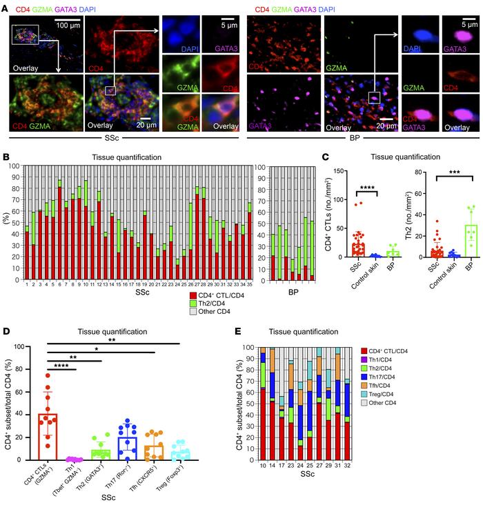 CD4+ CTLs are abundant in skin lesions of SSc patients.
(A) Representati...