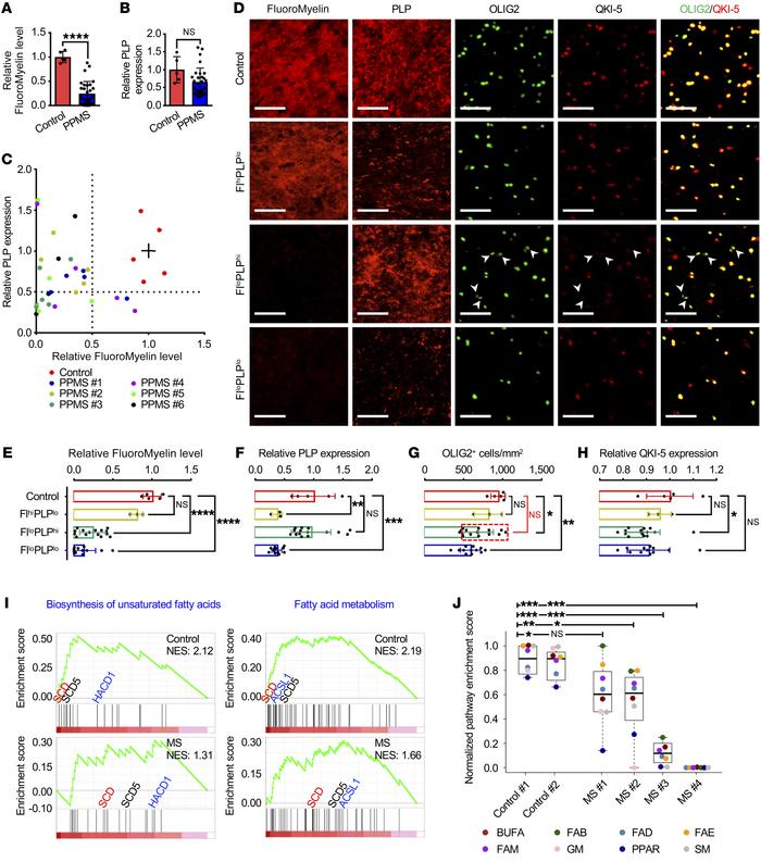 Lipids are more vulnerable than proteins in PPMS lesions.
(A and B) Quan...