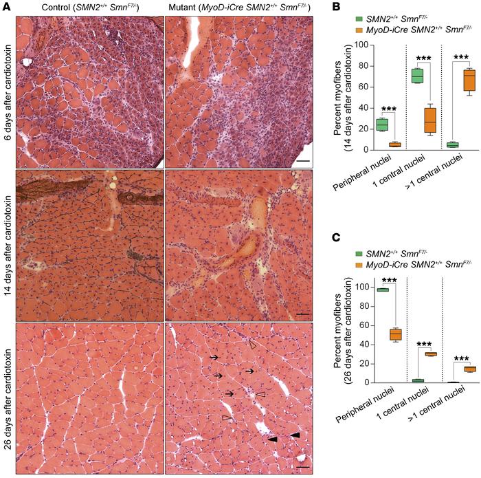 Acute injury unmasks muscle pathology in young adult MyoD-iCre SmnF7/– m...