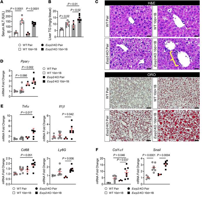 Depleting ESRP2 exacerbates alcohol-induced steatohepatitis in mice.
(A)...