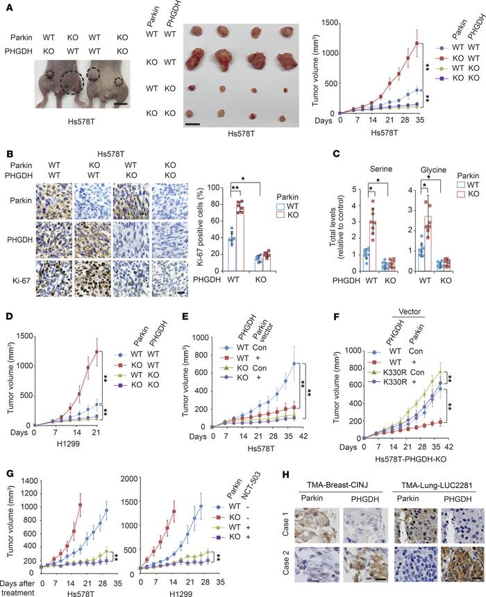 Parkin inhibits tumorigenesis through negative regulation of PHGDH.
(A) ...