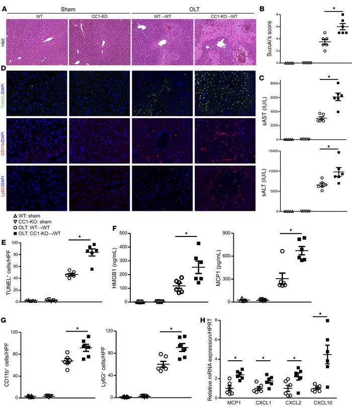 Hepatic CC1-null mutation exacerbates hepatocellular damage and inflamma...