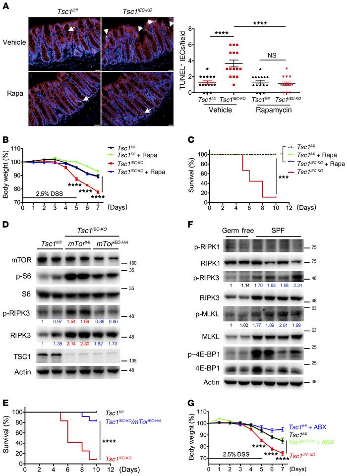 The microbiota/mTOR axis regulates epithelial necrosis and colitis.
(A) ...