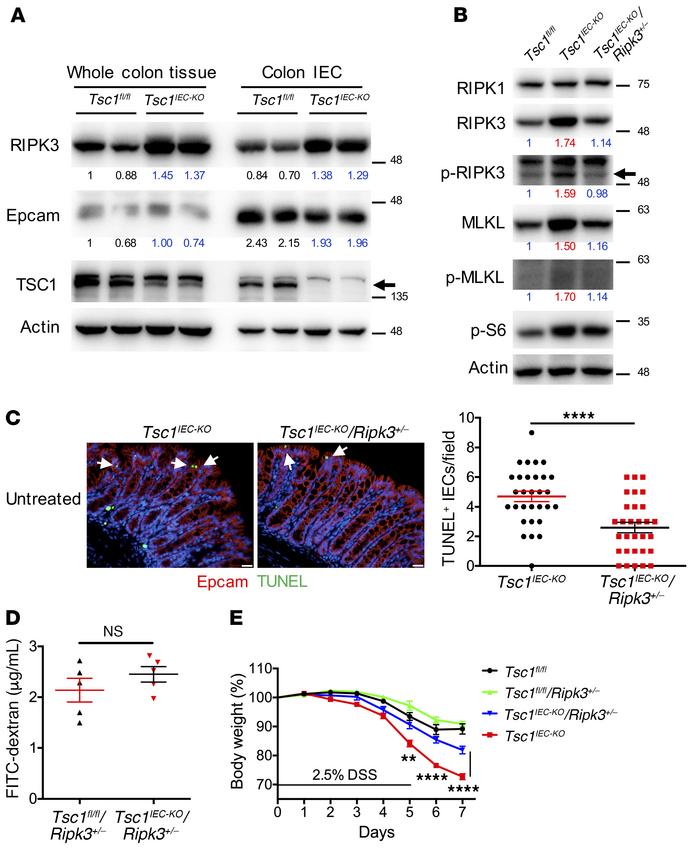RIPK3 accumulation correlates with severe IEC necroptosis and colitis.
(...