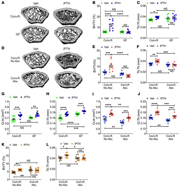 iPTH treatment fails to improve trabecular bone structure in GF mice and...