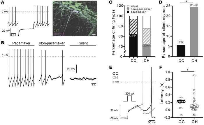Electrophysiological properties of DA neurons in the SN are changed due ...
