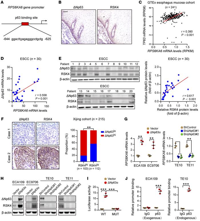ΔNp63α directly transactivates RSK4 expression in ESCC.
(A) Predicted bi...