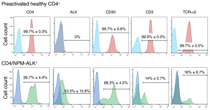 NPM-ALK–transformed CD4+ T lymphocytes immunophenotype.
Normal CD4+ T ce...