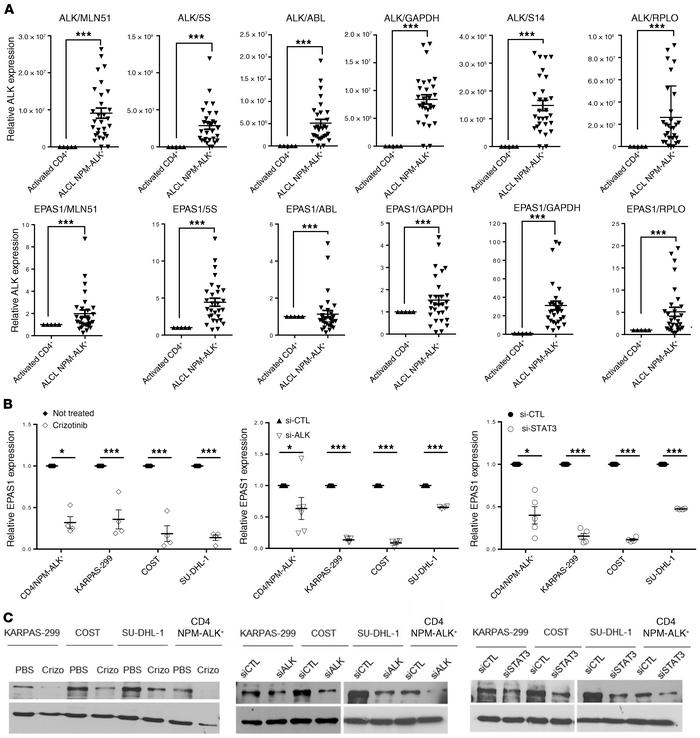 HIF2A, encoded by the EPAS1 gene, is strictly dependent on NPM-ALK activ...