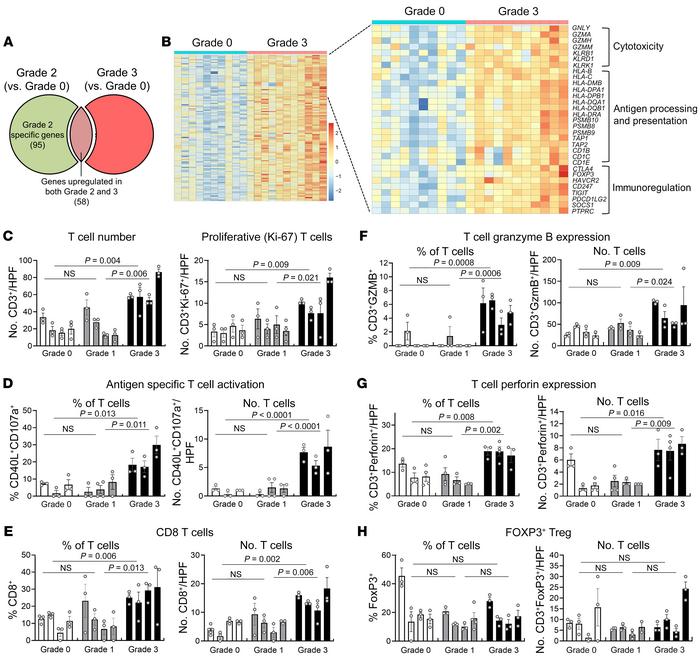 Severe rejection is characterized by upregulation of cytotoxicity, antig...