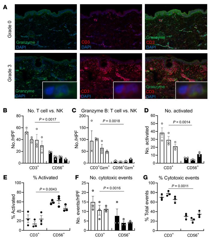 T cells are the major source of cytotoxic injury in grade 3 rejection.
(...