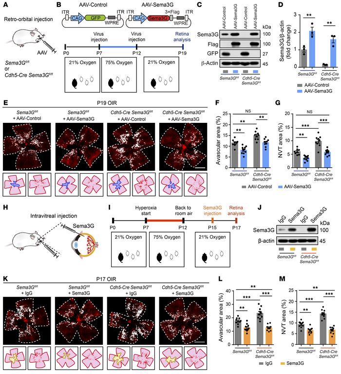 Supplementation of Sema3G ameliorates ischemic retinopathy in the OIR mo...