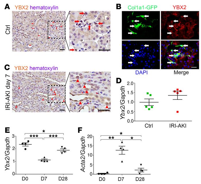 YBX2 expression in pericytes decreased after acute kidney injury.
(A) Re...