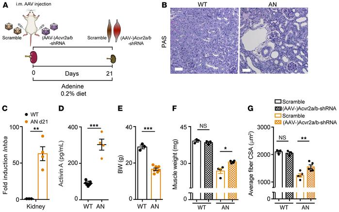 Muscle-specific downregulation of activin pathway protects from CKD-indu...