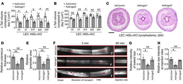 AdAngpt1 but not AdAngpt2 gene therapy attenuates lymphedema and improve...