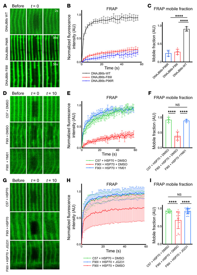 Imaging of DNAJB6 and HSP70 kinetics at the Z-disc.
(A) Fluorescence rec...