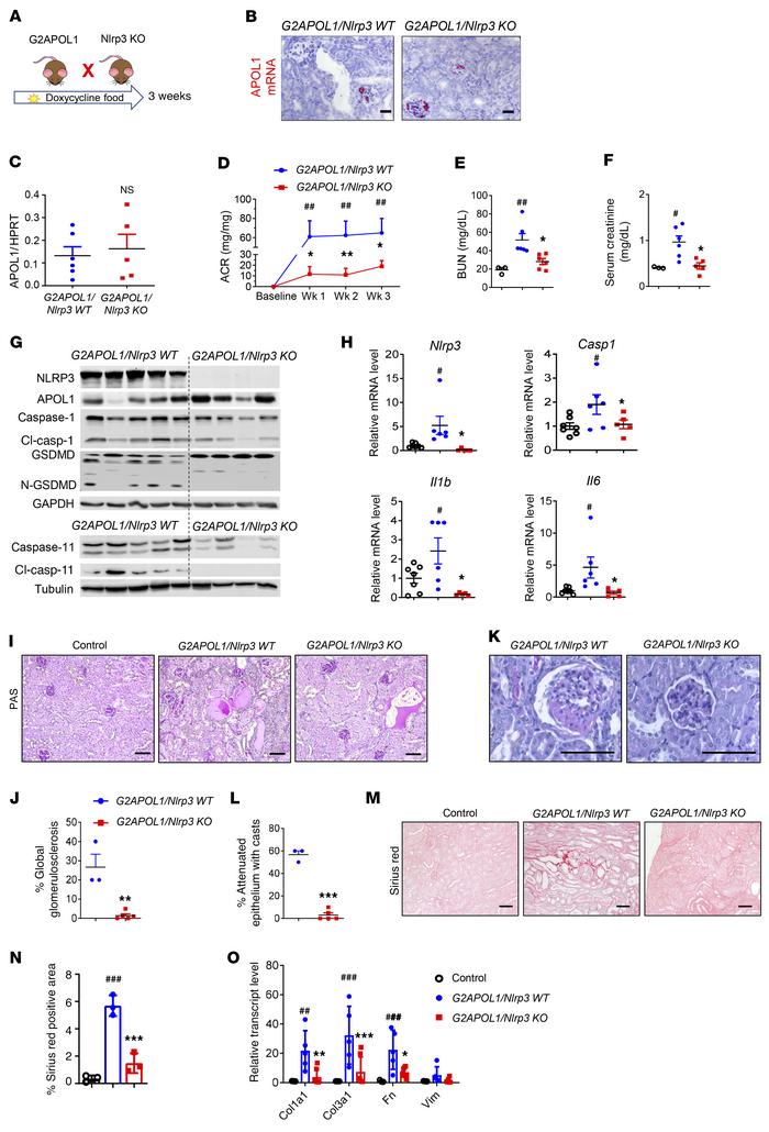 Genetic deletion of Nlrp3 in G2APOL1-transgenic mice markedly improves k...