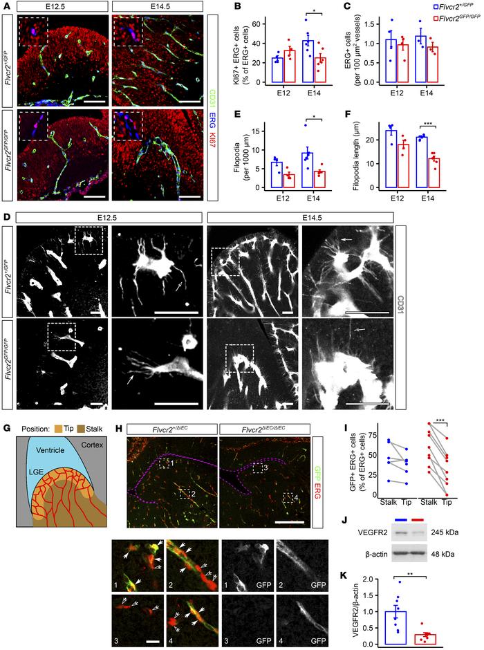 
Flvcr2 regulates endothelial cell sprouting in the developing brain.
(A...