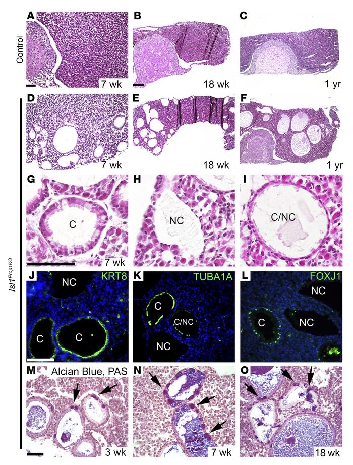
Isl1Prop1KO cysts expand with age and have characteristics of hRCCs.
(A...