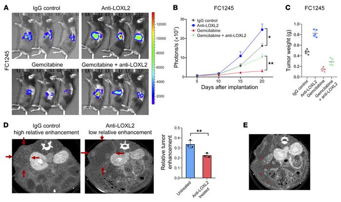 Reduction of fibrosis augments murine PDA progression.
(A) Representativ...