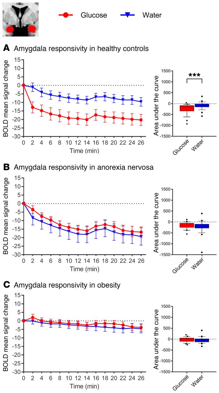 Changes in BOLD signal over time in response to glucose and water infusi...