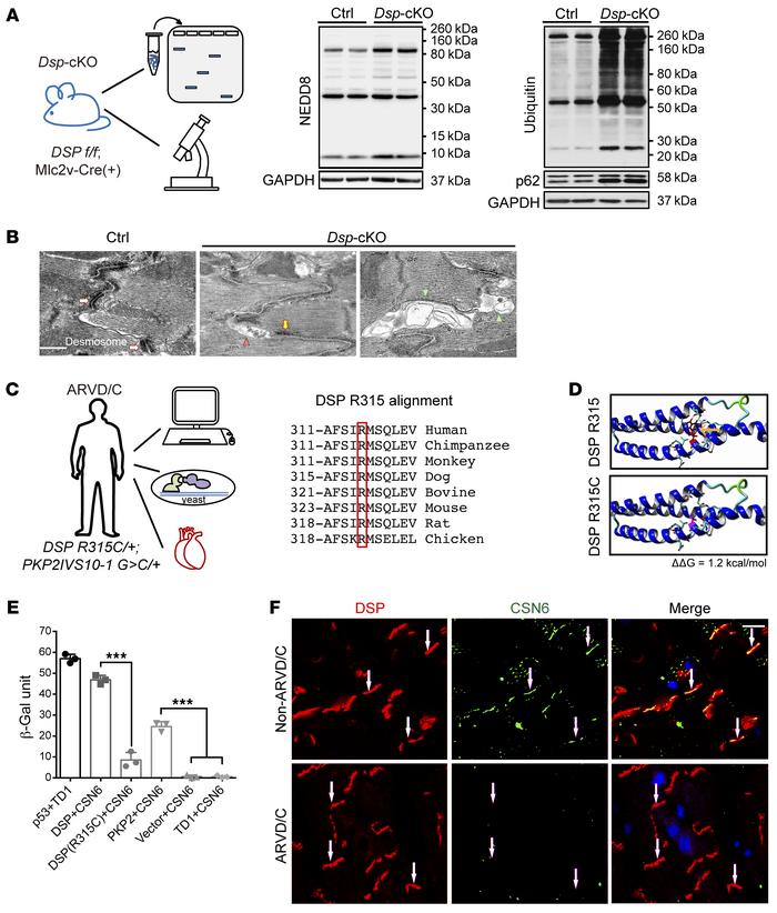 Disruption of the CSN6-desmosomal complex and protein degradation pathwa...